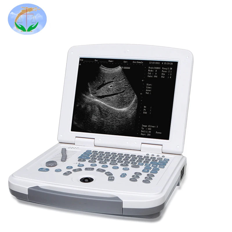 Hospital laptop ultrasound Scanner