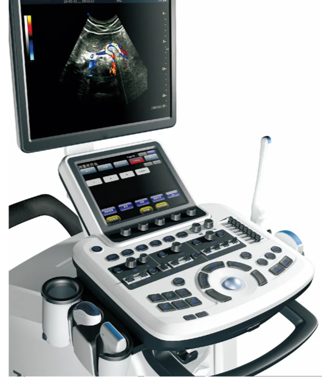 Digital Trolley 3D,4D Ultrasound Scanner