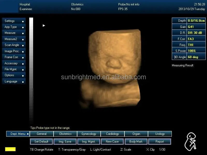 15 inch LED Cardiac ultrasound Echocardiography