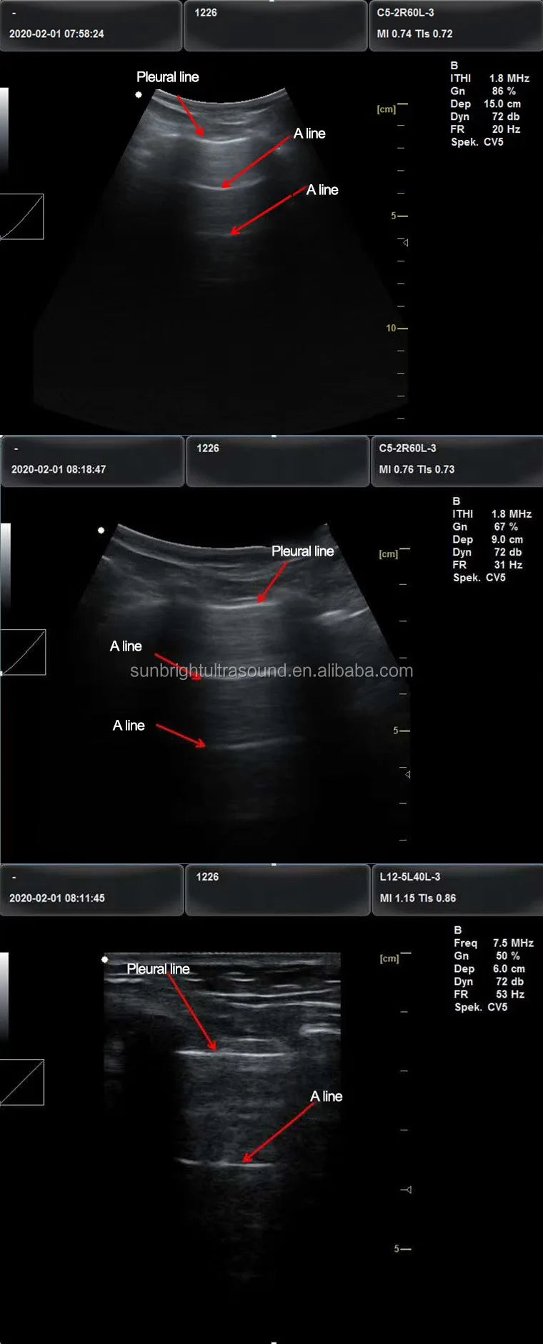 VetScan 3D: Portable Advanced Ultrasound