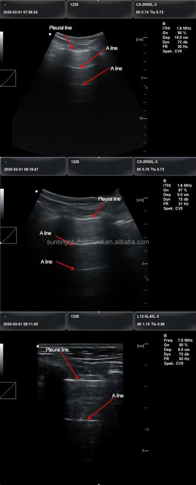 VetScan 3D: Portable Advanced Ultrasound