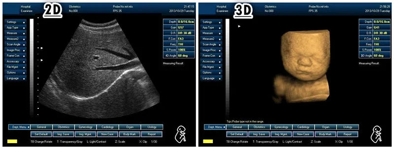 VetScan 3D: Portable Advanced Ultrasound