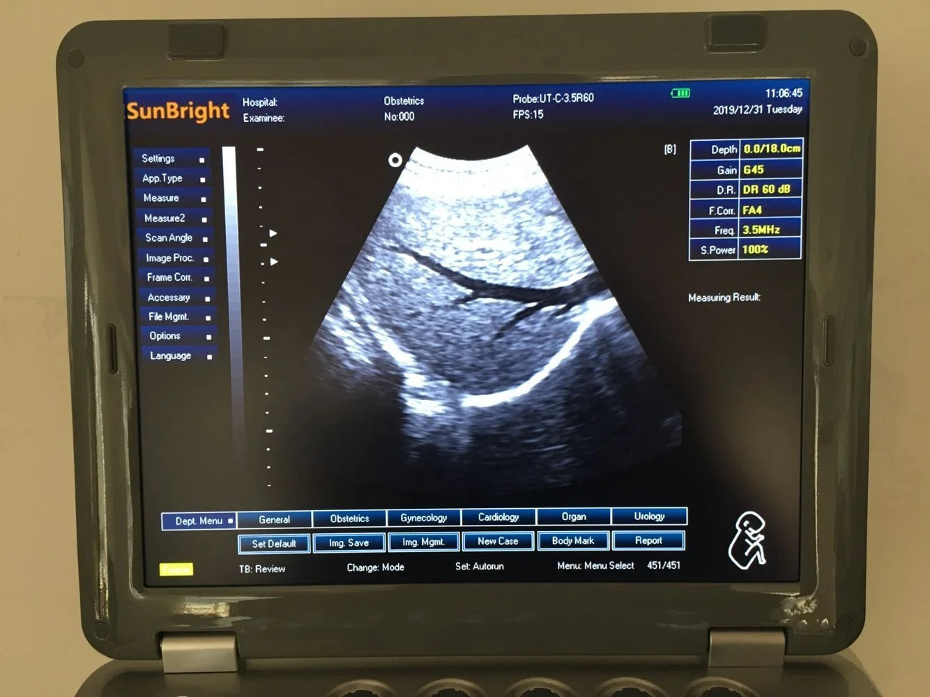 15 inch LED Cardiac ultrasound Echocardiography